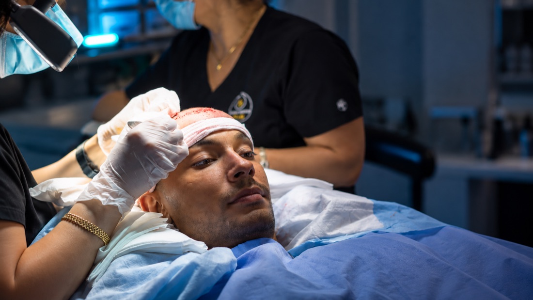 DHI hair transplant procedure in progress at Nova Medical Wisconsin, team member placing grafts along the hairline with an implanter pen